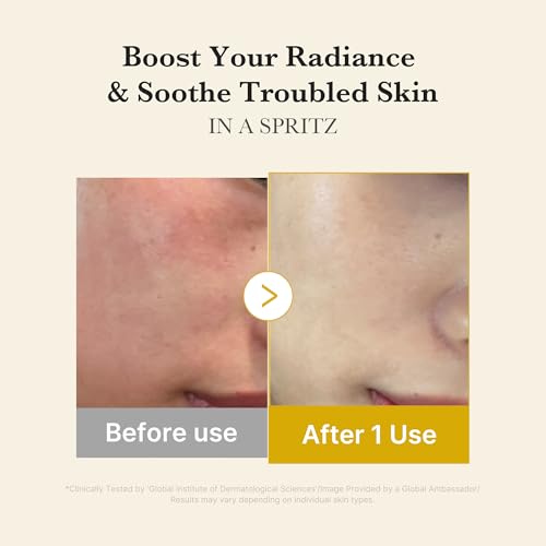 メディキューブ コウジ酸ビタゼリーセラムミスト スプレーセラム ミスト化粧水 ゼリテキスチャー 保湿ミスト 保湿セラム 潤いミスト エッセンスミスト 二層式 化粧水 敏感肌 乾燥肌 弾力 毛穴 キメ整える 中間 画像