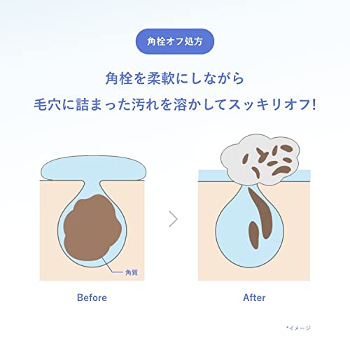 ORBIS(オルビス) 医薬部外品 クリアフル ローション さっぱり 化粧水 薬用 ニキビ 敏感肌 スキンケア 本体 180mL + ORBIS(オルビス) 医薬部外品 クリアフル ウォッシュ 濃密泡 洗顔フォーム ニキビ 敏感肌 スキンケア 洗顔料 無香料 単品 120g 中間 画像
