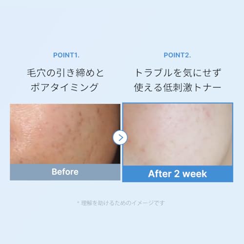 メディキューブ ゼロ毛穴トナー 250ml 低刺激 化粧水 拭き取り 水分保湿 しっとり ゆらぎ肌 オイリー肌 毎日 毛穴角質ケア ざらつき 敏感肌 スキンケア ゼロライン 中間 画像