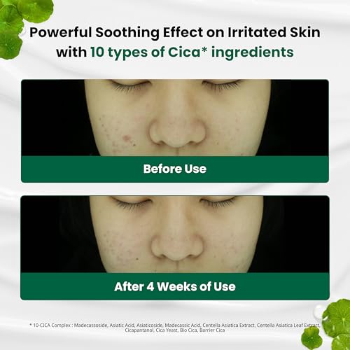 Dr.G(ドクタージー) R.E.D BLEMISH クリアスージングクリーム (50mL)の特徴・詳細 画像