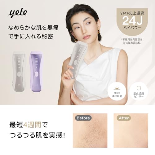 Yete（エイティー）脱毛器 IPL 冷感無痛ケア SHR連続照射 スキンセンサー搭載 自動/手動方式 6段階レベル 無限照射回数 VIO対応 全身対応可能 レディー脱毛器 家庭用 男女兼用 PSE安全認証済み 日本語取扱説明書付きの詳細・まとめ 画像