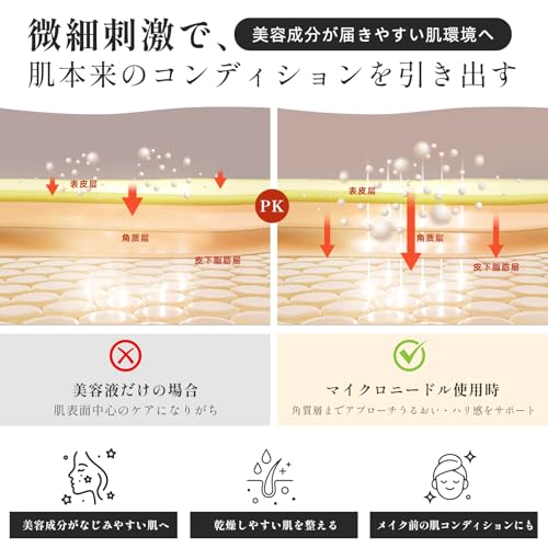 REXON マイクロニードルローラー 毛穴ケア・ハリ・たるみ・目元ケア・リフトアップフェイス＆頭皮対応｜美容・育毛ケア｜ブラックタイプ (0.5mm)の特徴・詳細 画像