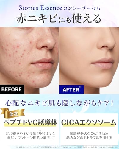 【 シミ消し ・ クマ消し 】 SEコンシーラー SPF50+ PA++++ 5gx1 カバー力 高い クマ しみ スティックコンシーラーの特徴・詳細 画像