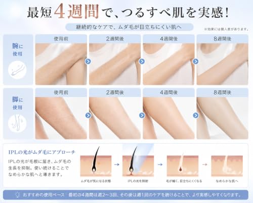 Sarlisi 脱毛器 VIO対応【冷却しながらハイパワー照射】サファイア冷却 最大20J HR+ 0.2秒高速連射 250g軽量 ヒゲ 全身対応の特徴・詳細 画像
