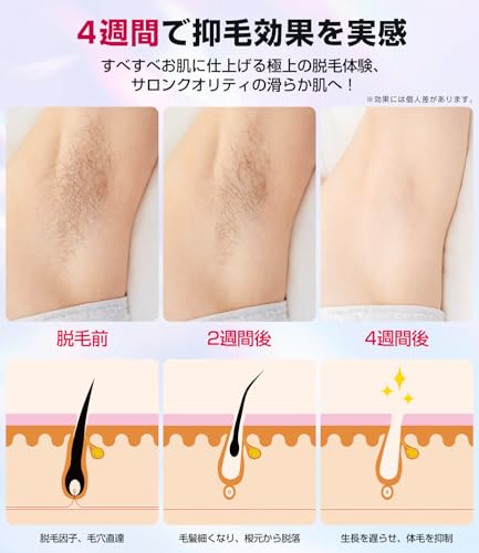 脱毛器 VIO対応【サロン級IPL光脱毛器/瞬間10℃冷却で低刺激】髭 メンズ レディース 全身適用 サファイア冷却 高出力 100万発5段階の特徴・詳細 画像
